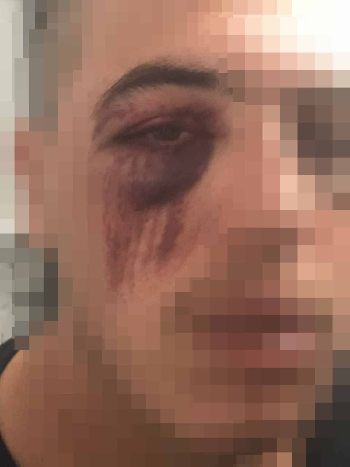 "לקחו אותם לסמטה ובסופו של דבר הם נראים ככה". אחד החשודים לאחר האירוע האלים