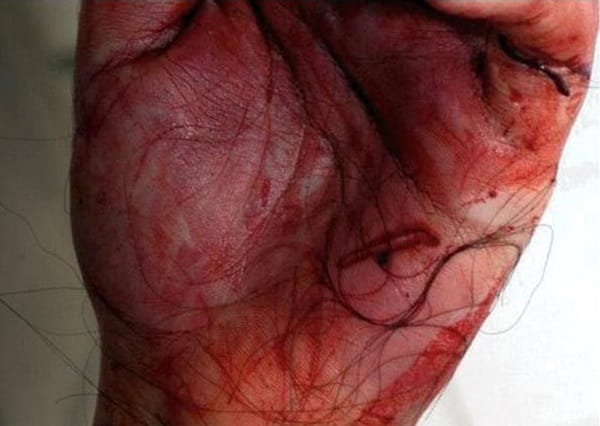 תאיר ראדה - נאבקה ואחזה בשערות אדם