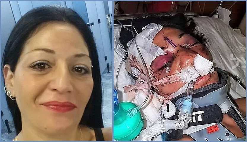 ככה היא נראית עכשיו (מימין), וככה היא נראתה לפני (משמאל)