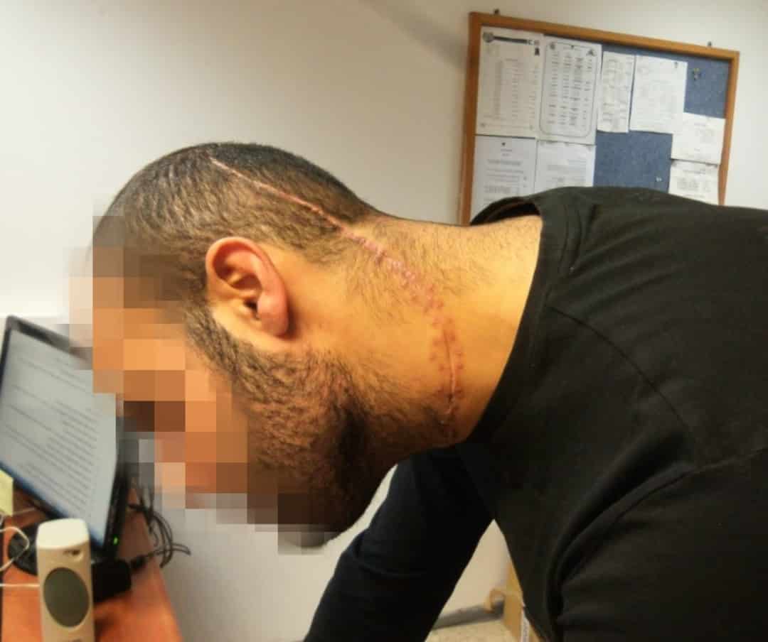 קורבן התקיפה והצלקת בראשו