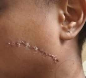 קורבן תקיפה ממיכאל 600