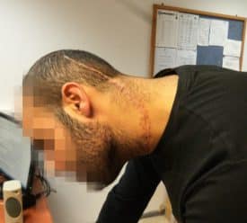 חתך בפנים - תיק ניסים חג'אג'