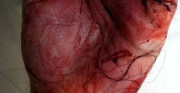 הוצאה מהקשרה – גרסת הפרקליטות לראיה החדשה בתיק רצח תאיר ראדה