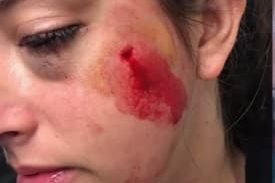 15 חודשי מאסר לאוהד הפועל ת"א שפצע מאבטחת במשחק כדורסל