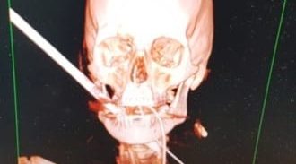 הנס של נתנאל ג'