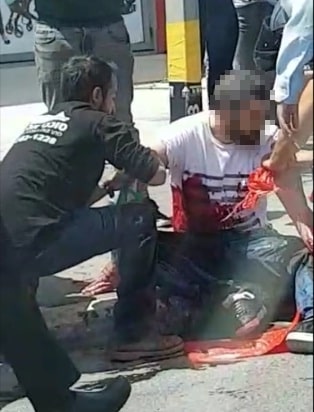 א' מטופל לאחר שנדקר (צילום: רשתות חברתיות)