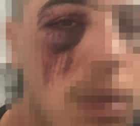 חשוד פצוע לאחר קטטה מתחם התחנה תל אביב