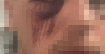 ת"א: קטטה במתחם התחנה הסתיימה בתלונות על אלימות שוטרים