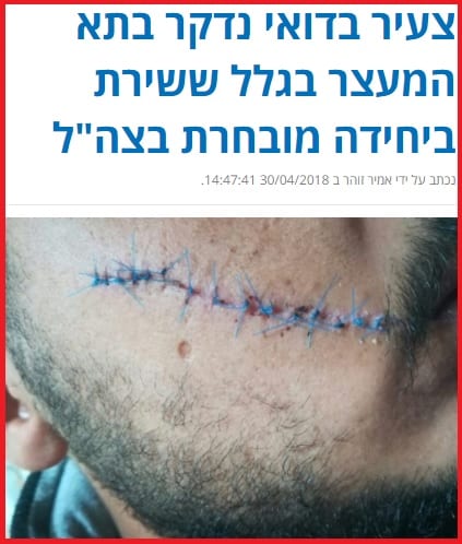 חשיפת פוסטה מחודש אפריל (לחצו כאן לכתבה המלאה)