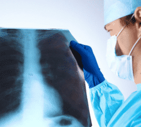 אילוסטרציה טכנאי רנטגן מאתר בחו"ל 600