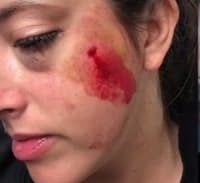 אישום נגד אוהד הפועל ת"א: זרק בקבוק על מאבטחת ופצע אותה