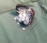 תעלומת הבלדר המת מקוסטה ריקה