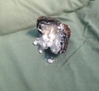 שלוש שנות מאסר לבן 60 שייבא 67 זרגי קוקאין בגופו