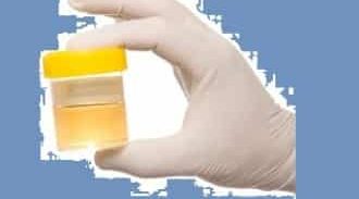 השוטר אזולאי ובדיקת השתן שיצאה מהארון