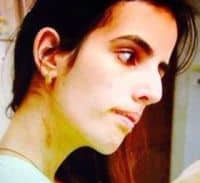 מח"ש סגרה את התיק נגד בלשים שגרמו לצעירה שבר בגולגולת