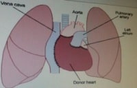 מתנה מקזחסטן: הפרקליט שהחתים על הסכמי סחר באיברים