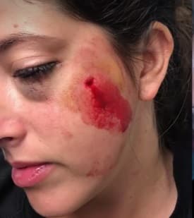 meavtahat pziaa hapoel tel aviv