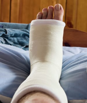 רגל שבורה מאחורי הסורגים. אילוסטרציה