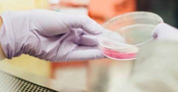 המשטרה איבדה פריטים עם כתמי דם, הדוקר זכה להסדר טיעון