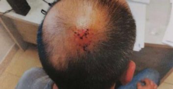 אשדוד: שלושה קטינים רוכבי קטנועים חשודים בתקיפת נהג שהעיר להם