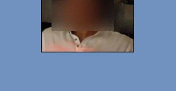 תיק אבוטבול: רות דוד והחסינות של האתרוג