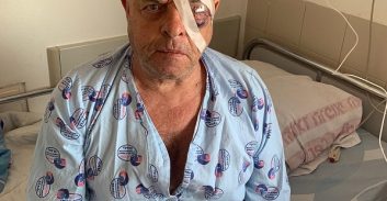 פנסיונר הותקף ללא סיבה לאור יום באשקלון: "מפחיד ללכת ברחוב"