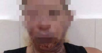 אישום: הצית את ארוסתו יומיים בלבד לאחר לידת בתם המשותפת