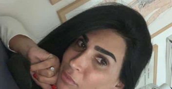 כאבי גב בגיל 35