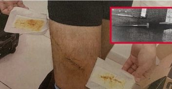 מעצר בית באיזוק אלקטרוני לנאשם בדקירת עבריין עם מברג פיליפס