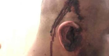 המסיכה, והפצצה