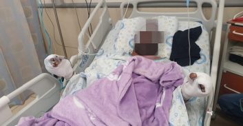 אחיו של חשוד ברצח כפול נפצע קשה מרימון שנזרק לעבר ביתו