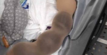 העונש לצעירים מביתר עילית שייבאו מאוקראינה אלפי זרעי קנאביס