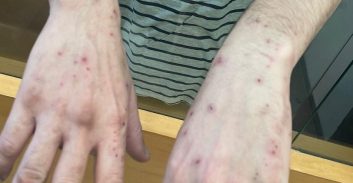 לשכת עורכי הדין והסנגוריה הציבורית נגד תנאי המעצר בג'למי