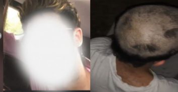 חשד: תקף וסחט עובד בתחנת דלק וגילח את שערו