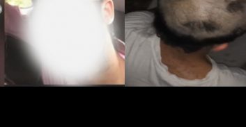 אישום: כיפה אדומה וגילוח ראש לעובד תחנת הדלק בשדרות רוקח