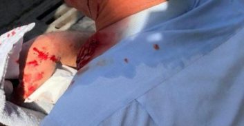 תושב צפת חשוד בדקירת נהג אוטובוס עם בקבוק בירה שבור