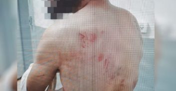 עצור טוען שהותקף פיזית ומינית על ידי שוטרים וסוהרים