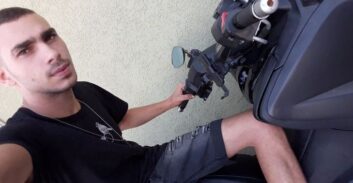 אסיר תפר לעצמו את השפתיים במחאה על הפסקת טיפול במשככי כאבים