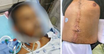 חתן שנדקר על ידי אחי הכלה וביקש להתגרש יחוייב בכתובה