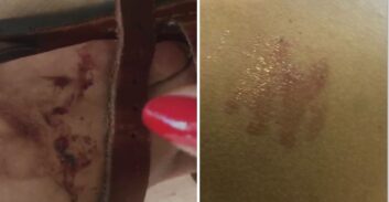 החשד: תקפה את בן זוגה, ואת השוטר שהוזעק לביתם