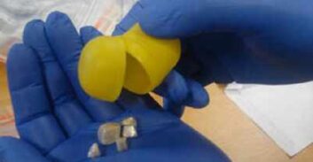 בני זוג מלוד נעצרו בחשד לסחר והחזקת סמים בביצי קינדר