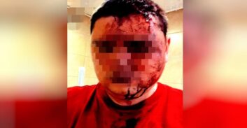 לינץ' בטיילת בת גלים בחיפה נגמר ב-15 חודשי מאסר בלבד