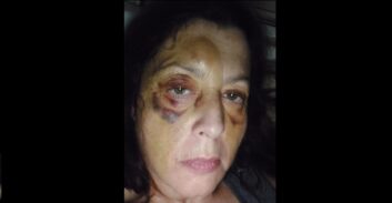 ערעור נגד סגירת תיק במשטרה נגד בר-מן שתקף קשות שחקנית תיאטרון