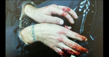 ירושלים: הפורץ ניפץ חלון ראווה כדי לגנוב קורקינט, ונפצע בידיו