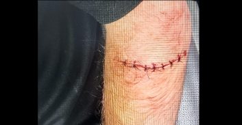 אישום: תקף ופצע נהג שצפר לו במהלך פקק תנועה בבני ברק