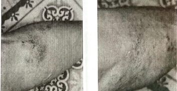 העונש לגבר מעכו שהורשע בתקיפת אחותו ובאיומים על אחותו השנייה