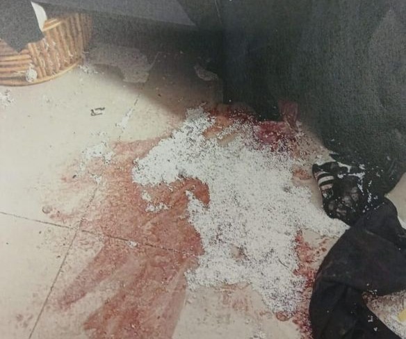 דם רימון רסס ירי