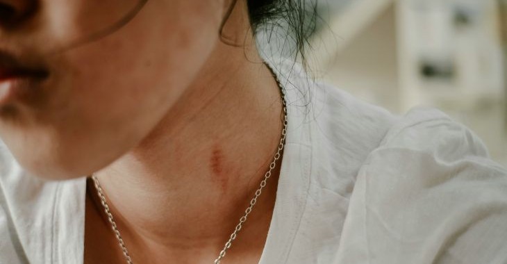 אלימות חבלות אשה חיצונית