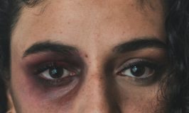 גרם לשברים ועקירה בפניה של גרושתו – ולא נשלח למאסר בפועל