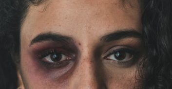 נשים על הכוונת? הרחבת האיזוק האלקטרוני יכולה לסייע